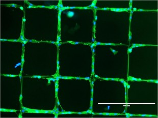Cells on patterned collagen scaffolds from Zubarev laboratory