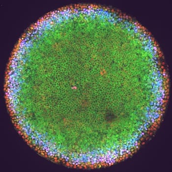 Green fluorescent tags in a colony of human endothelial stem cells show high activity as they organize themselves into a pattern 40 hours after the BMP4 signaling pathway is activated. Rice University biosciences carried out experiments on contained colonies of cells to learn new details about how they're triggered to differentiate in embryos. Courtesy of the Warmflash Lab