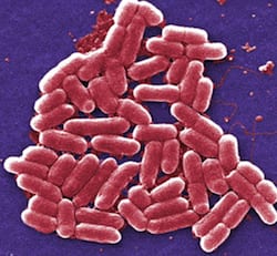 Rice University scientists have built a model to predict how long, on average, it takes to eradicate bacterial infections like those caused by shigella, above, with antibiotics. The model could help doctors fight resistance by prescribing antibiotics that neither over- or under-dose a patient. (Credit: U.S. Centers for Disease Control and Prevention)