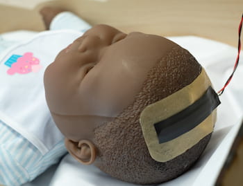 A system developed by Rice University engineering students is designed to monitor high intracranial pressure within the skulls of infants, a condition that affects more than 400,000 every year. (Credit: Jeff Fitlow/Rice University)