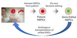An illustration shows the process by which a patient's own hematopoietic stem and progenitor cells (HSPCs) can be removed, their genes edited and the corrected hematopoietic stem cells (HSCs) returned to treat sickle cell disease. (Credit: Illustration by Gang Bao/Rice University)