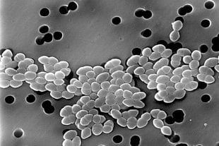 SEM image of vancomycin-resistant Enterococci