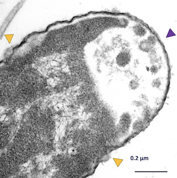 A Klebsiella pneumoniae bacteria exposed to motorized nanomachines invented at Rice University and the antibiotic meropenem shows signs of damage in a transmission electron microscope image. The yellow arrows show areas of cell wall disruptions, while the purple arrow shows where cytoplasm has escaped from the cell. (Credit: Don Galbadage/Texas A&M)