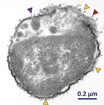 A Klebsiella pneumoniae bacteria exposed to motorized nanomachines invented at Rice University and the antibiotic meropenem shows signs of damage in a transmission electron microscope image. The yellow arrows show areas of cell wall disruptions, the purple arrow shows where cytoplasm has escaped from the cell, and the red arrow shows cytoplasmic leakage. (Credit: Don Galbadage/Texas A&M)