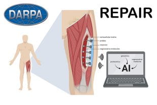Illustration showing how REPAIR, a smart electronic patch, will help regrow muscle tissue