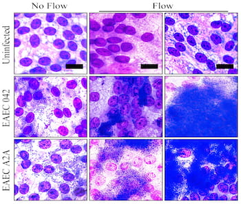 The transparent mPC bioreactors developed by Rice University and Baylor College of Medicine allow for easy imaging of interactions between intestinal cell cultures and bacteria or other pathogens. These microscope images show stained epithelial cells infected with enteroaggregative Escherichia coli with and without flow through the mPCs after 8 hours. The images show bacteria inserted without flow aggregated into small clusters (left), but formed biofilms when flow was present (center and right). The scale bars are 30 microns. (Credit: Baylor College of Medicine/Rice University)