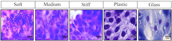 A comparison of E. coli cultures on enteroids grown on a selection of surfaces shows hydrogels developed at Rice University are effective mimics of intestinal environments for lab experiments. (Credit: Rice University/Baylor College of Medicine)