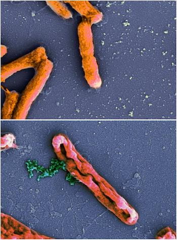 An electron microscope image shows intact Escherichia coli bacteria at top and E. coli leaking chromosomes (green) after disruption by an antimicrobial peptide at bottom. New models by Rice University scientists have determined peptides that invade bacteria and do their damage from the inside are underrated. (Source: Wikipedia)