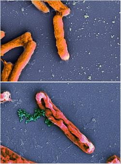 An electron microscope image shows intact Escherichia coli bacteria at top and E. coli leaking chromosomes (green) after disruption by an antimicrobial peptide at bottom. New models by Rice University scientists have determined peptides that invade bacteria and do their damage from the inside are underrated. Source: Wikipedia