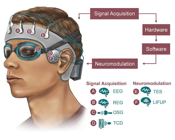 Rice University engineers, in collaboration with Houston Methodist and Baylor College of Medicine, are developing a noninvasive skullcap to better understand how the brain disposes of metabolic waste while the wearer sleeps. Signals will be acquired will be through electroencephalogram (EEG), rheoencephalography (REG), orbital sonography (OSG) and transcranial doppler (TCD), with modulation through transcranial/transcutaneous brain and nerve electrical simulations (TES) and low-intensity focused ultrasound pulses (LIFUP). (Credit: NeuroEngineering Initiative/Rice University)